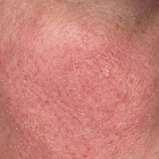 baza pod makijaż prebiotyczna Mleczko - esencja nawilżająco rozświetlająca glazed skin effect