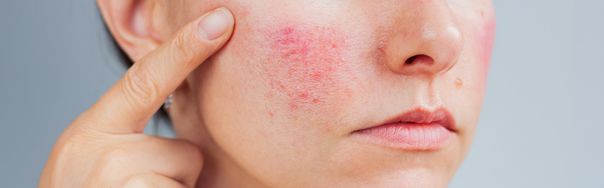 Co wpływa na podrażnienie skóry twarzy, czego unikać?