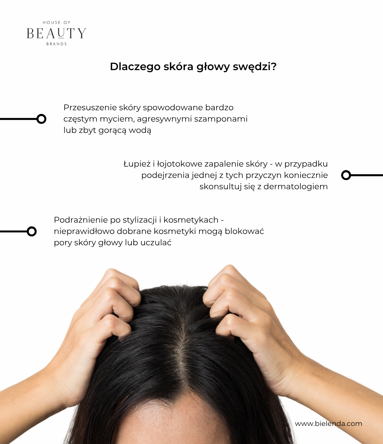 swędzenie skóry głowy